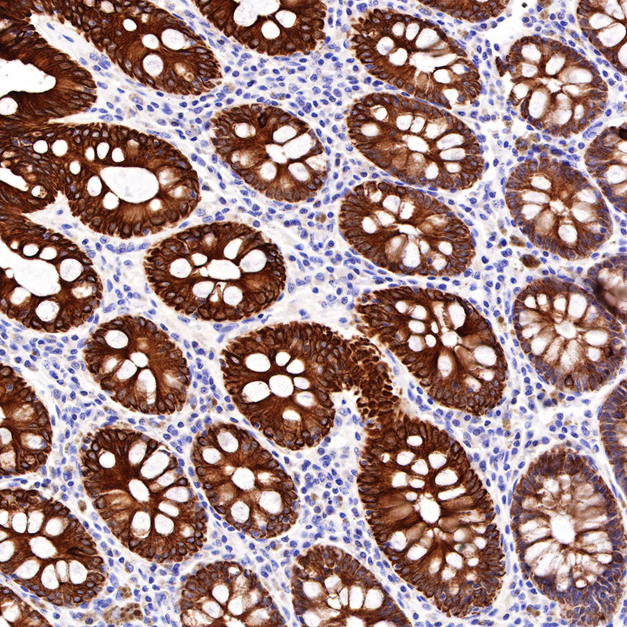 The Essential Role of CK-Pan Antibody in Cell Biology and Tumor Research