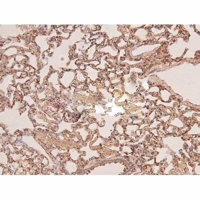 Mechanisms, Disease Links and Therapeutic Prospects