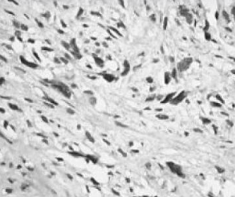 The Critical Role of SEK2 (MKK4/MAP2K4) in Cellular Stress Signaling and Disease Pathways