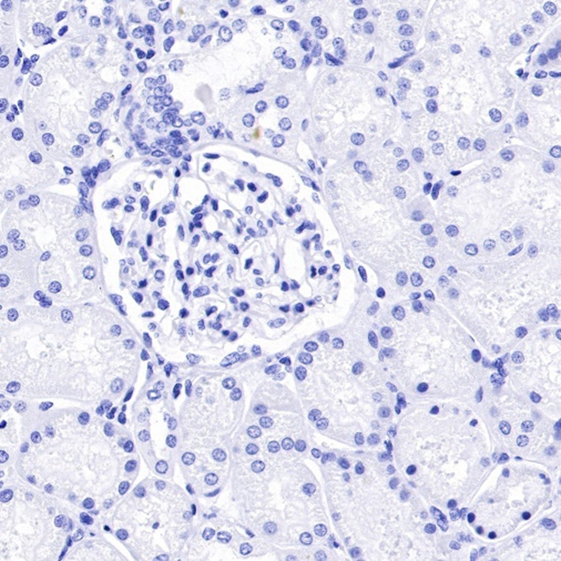 Unlocking the Secrets of RBM10: A Master Regulator of Cellular Homeostasis