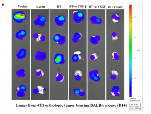 Bispecific Antibody Combined with Radiotherapy Breaks Through Tumor Therapy Bottlenecks!