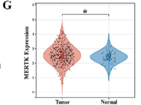 Single-Cell and Spatial Transcriptomics Reveal the Key Axis of PTMC Progression