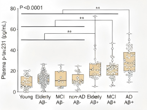 Plasma p-tau231 Antibodies: Can They Become a New Tool for Early Pathological Detection of Alzheimer's Disease?