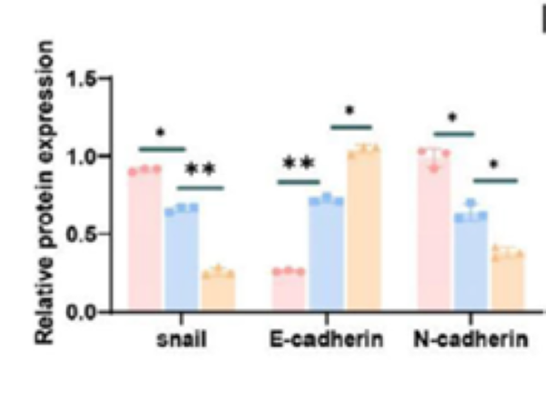 Advances and Applications of Protein Propionylation in Metabolic Regulation and Disease Research