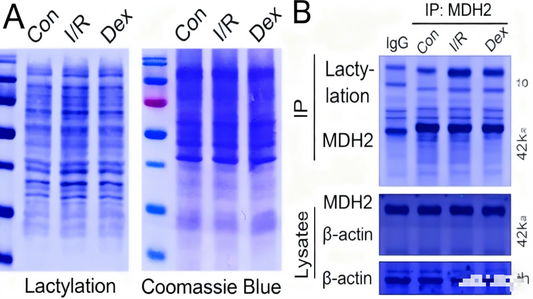 Pan-Specific Modification Antibodies: How Do They Open New Horizons in Protein Post-Translational Modification Research?