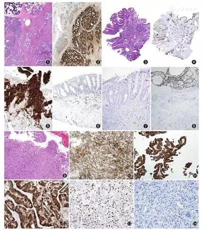 How Are Classic Pathology Antibodies Gaining New Life?