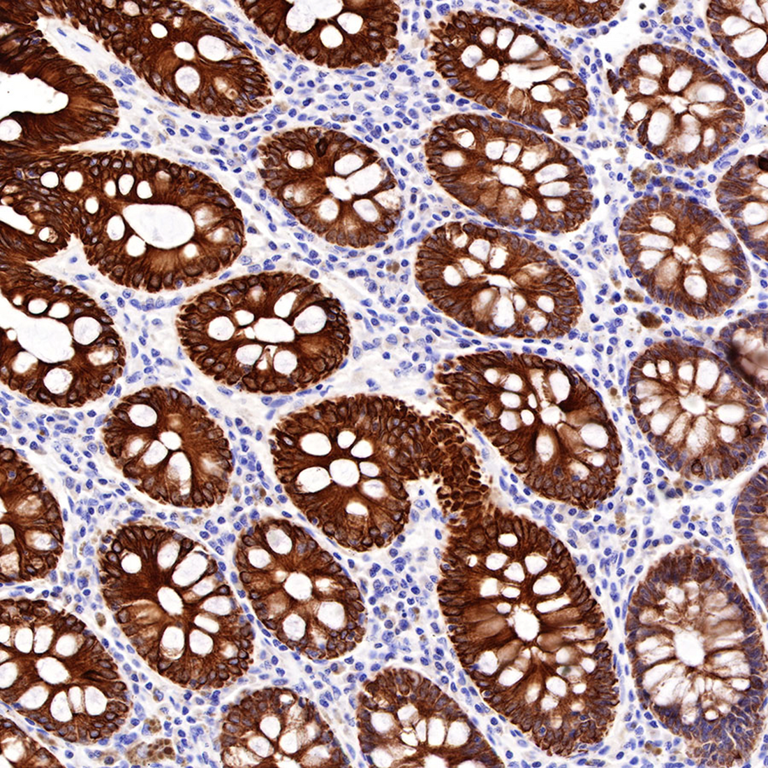 What is the key role of CK-Pan antibody in cell biology research?