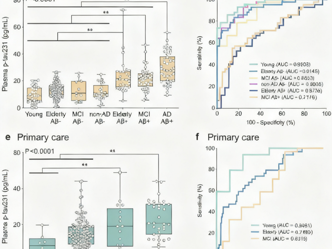 Plasma p-tau231 Antibodies: Can They Become a New Tool for Early Pathological Detection of Alzheimer's Disease?