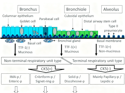 CK5/6 antibody: How does it reveal the clinicopathological significance of the basal-like phenotype in lung adenocarcinoma?