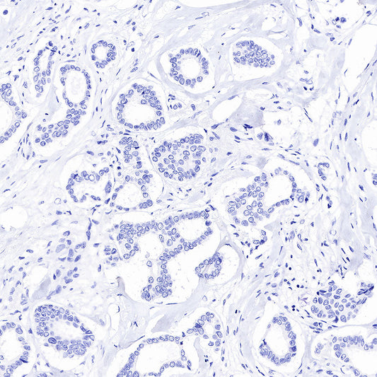 How Customized Antibodies in Biomedicine Drive Drug Development
