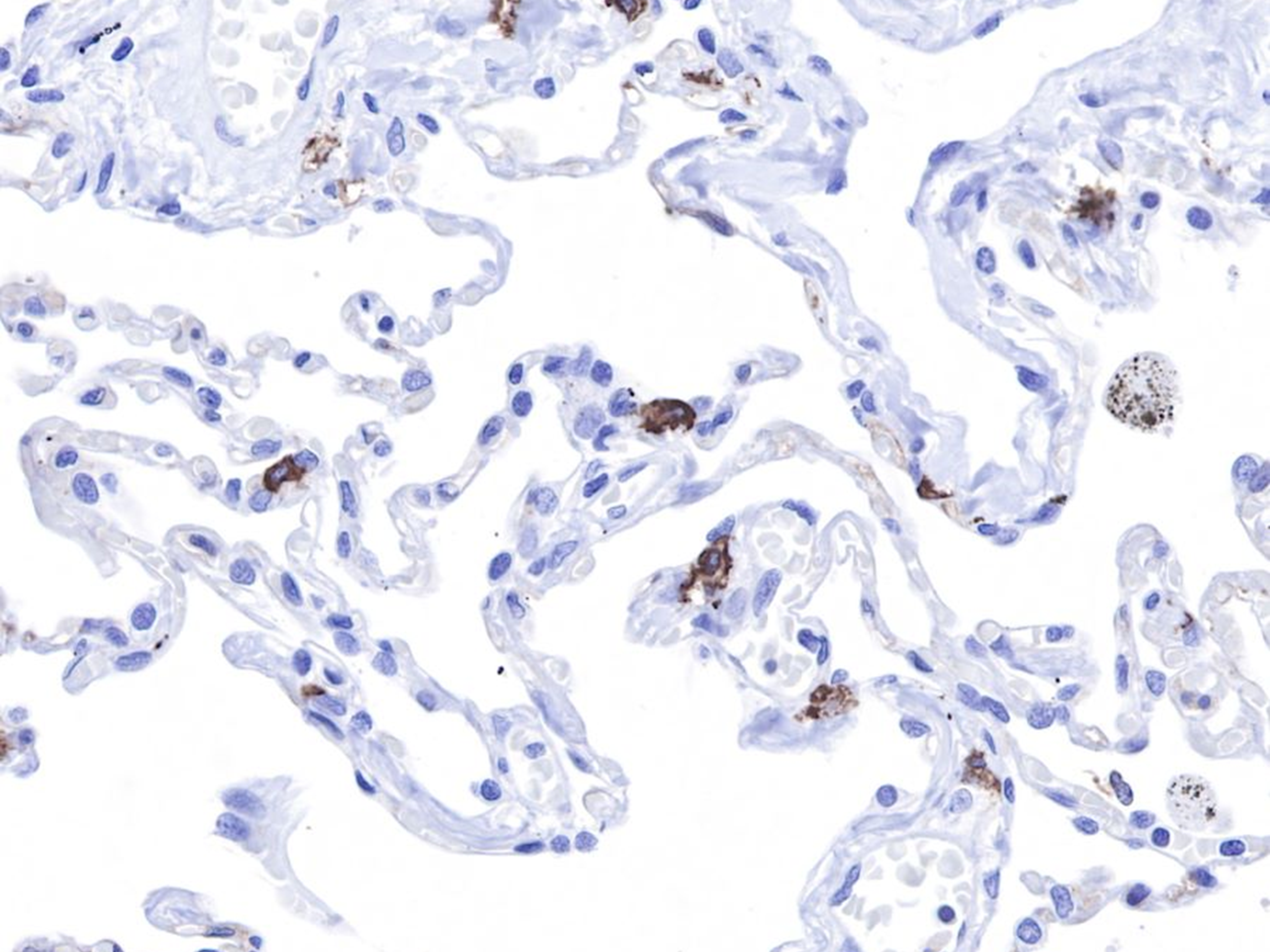 What are the applications and quality control strategies of CD117 anti ...