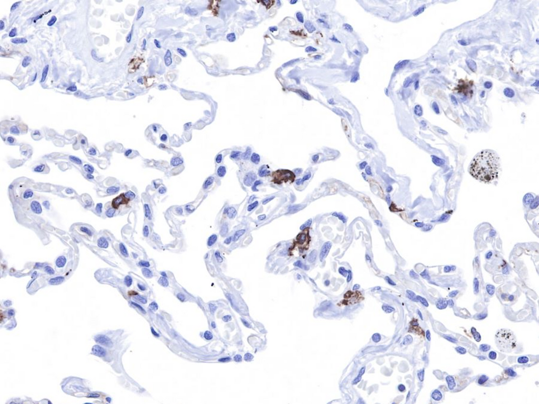 What are the applications and quality control strategies of CD117 antibody in immunohistochemical detection?