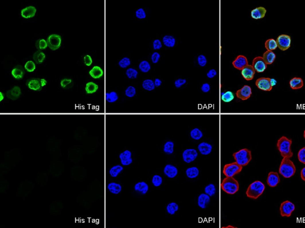 What is the principle and application strategy of His-tagged protein purification technology?