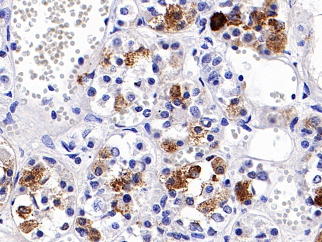 Can FSHB Antibody Become a Novel Target for Intervening in Ovarian Aging?