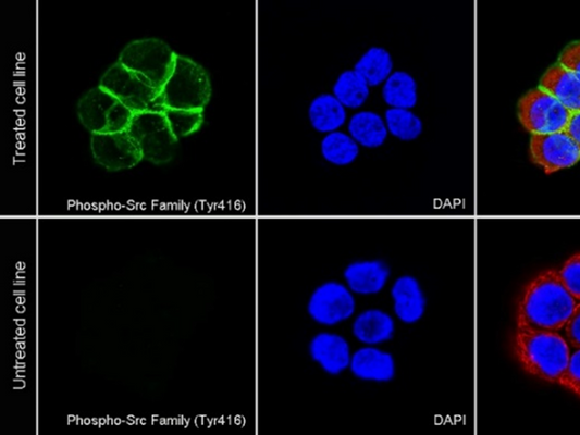 How does electrostatic interaction regulate the initiation of T cell receptor signaling?