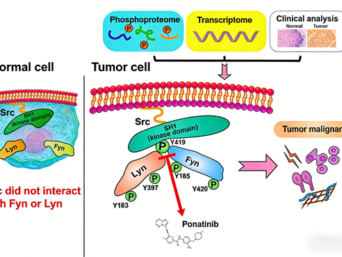 How does Src drive the progression of esophageal squamous cell carcinoma through heterodimerization?