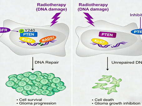 How does tyrosine phosphorylation of nuclear PTEN regulate the radiosensitivity of gliomas?