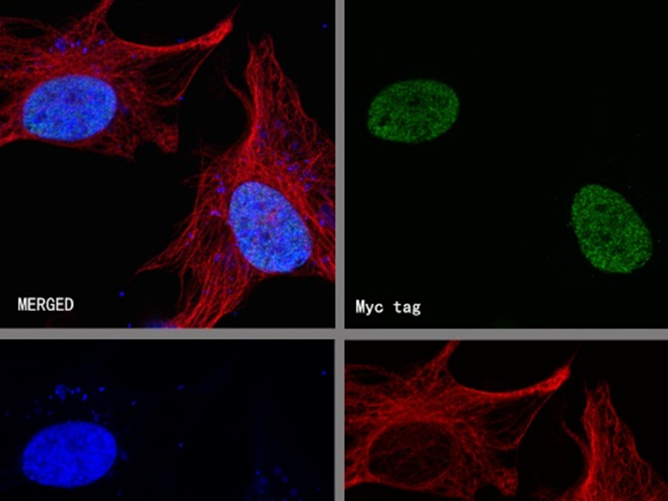 How to utilize the tag-antibody system for efficient detection and purification of recombinant proteins?