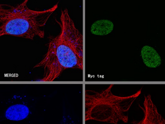 How to utilize the tag-antibody system for efficient detection and purification of recombinant proteins?
