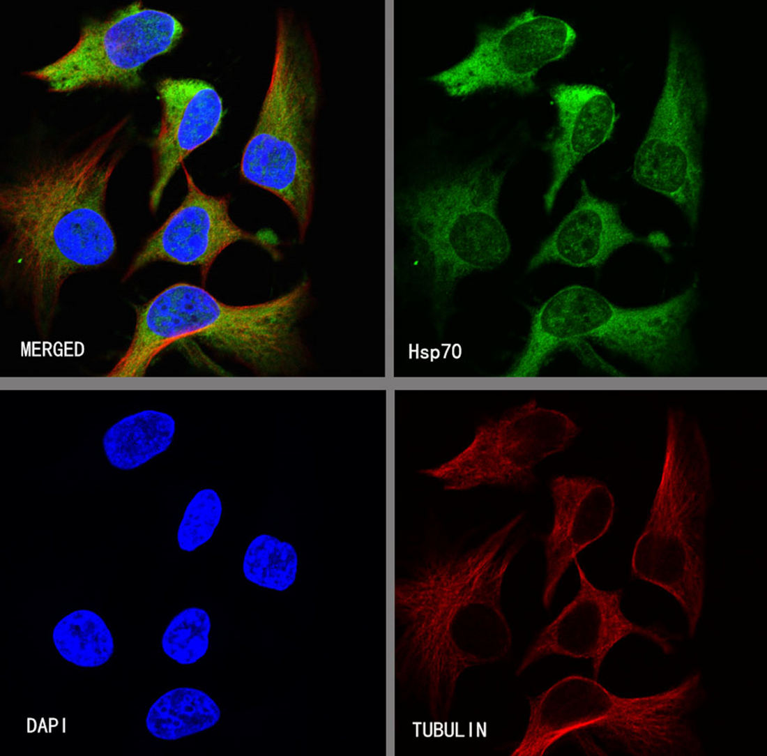 How to scientifically select and apply internal reference antibodies to ensure the accuracy of Western Blot data?