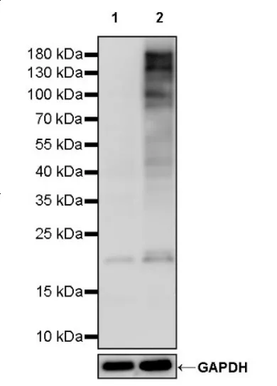 Classic modification of serine/threonine phosphorylation, accurately interpreting the mystery of cell signaling