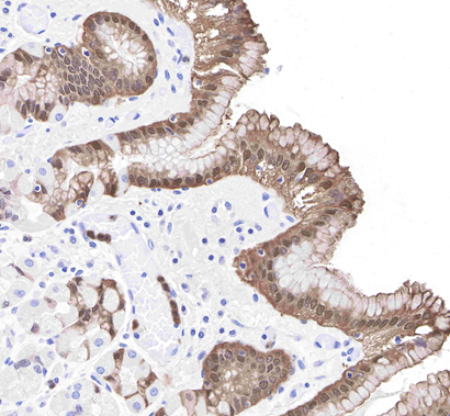 How does the S100P antibody reveal the molecular mechanism by which GnRH antagonists affect endometrial receptivity