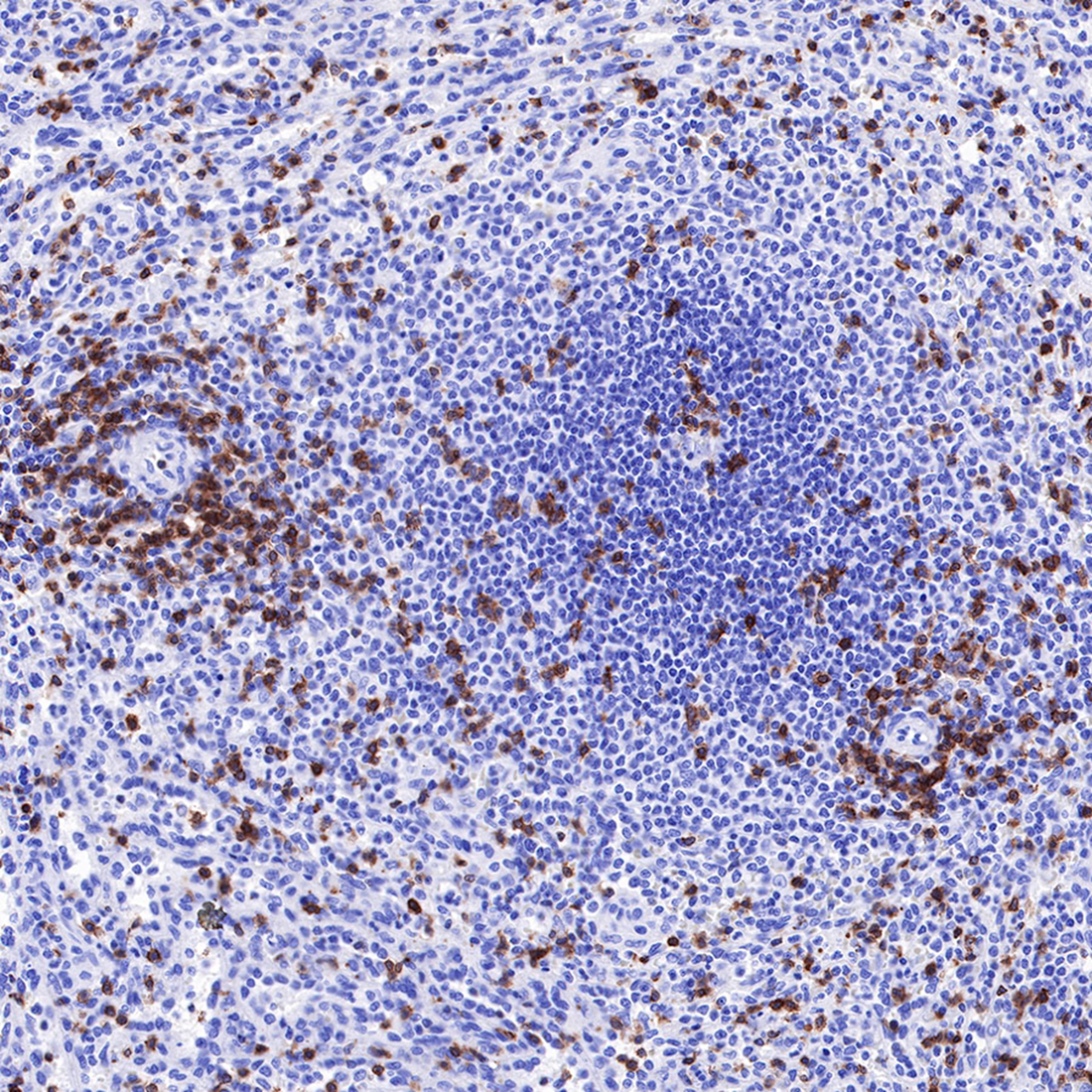 T3E Antibodies: A Comprehensive Analysis from Structural Characteristics to Clinical Applications