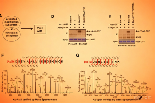 Acetylation Antibodies: How Do They Reveal the Key Role of N-terminal Acetylation in Autophagy Regulation?