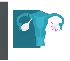 Mechanistic Roles of Mucin-16 in Ovarian Cancer