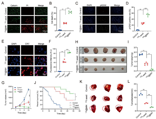 Unlocking Radioresistance Reversal: A Literature Analysis of 125I@MH Seed Therapy Empowered by ANT BIO PTE. LTD. Products