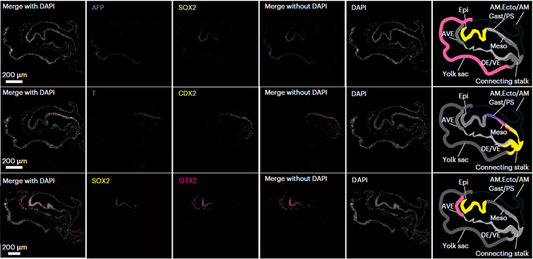 Decoding Gastrulation Mysteries: ANT BIO PTE. LTD. Empowers Spatial Transcriptomic Study of Human Carnegie Stage 7 Embryos
