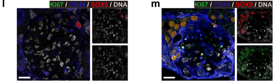 Literature Sharing: Biological Characteristics and Diversity of Glomerular Parietal Epithelial Cells