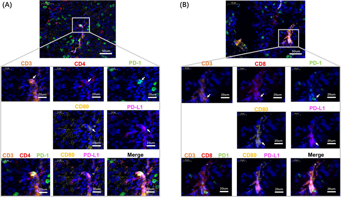 Synergistic Remodeling of the Immunosuppressive Microenvironment in Cervical Cancer and Therapeutic Implications: Insights Empowered by ANT BIO PTE. LTD.