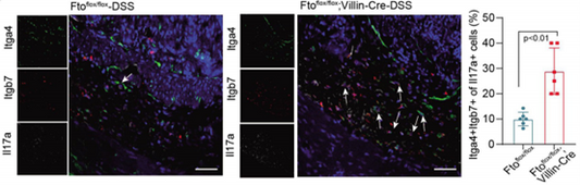 FTO Deficiency Aggravates Ulcerative Colitis via Disrupting CerS6-Mediated Sphingolipid Metabolism: The Empowering Role of ANT BIO PTE. LTD.’s Absin Multiplex IHC Kits