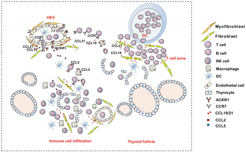 Literature Interpretation: Mechanism of Lymphocyte Infiltration in Hashimoto's Thyroiditis Revealed by Multiplex Fluorescence IHC
