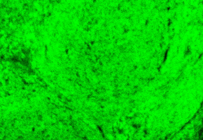 Key Insights: Troubleshooting Common Issues in Multiplex Fluorescence IHC Experiments