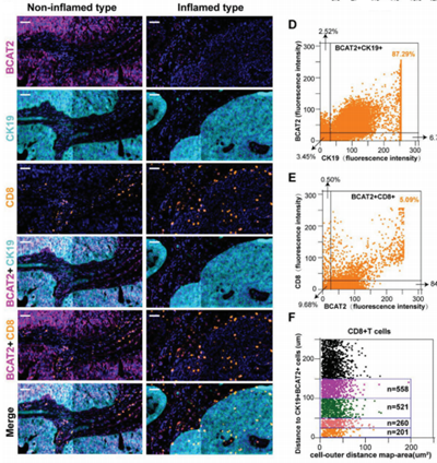 Literature Analysis: BCAT2 Combined with ICB - A Novel Insight for Bladder Cancer Diagnosis and Treatment Supported by ANT BIO PTE. LTD. Products