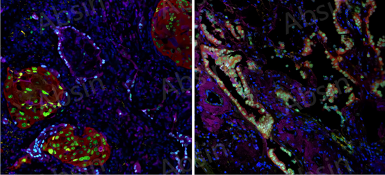 Comprehensive Guide: Culture and Multiplex Fluorescence IHC Identification of Lung Cancer Organoids