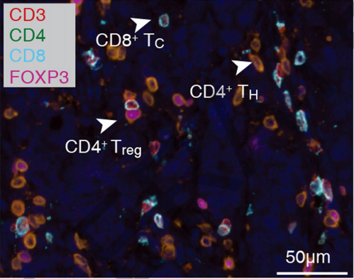 Literature Analysis: Application of Multiplex Fluorescence IHC in Characterizing Subtypes and Functions of T Cells in Colorectal Cancer