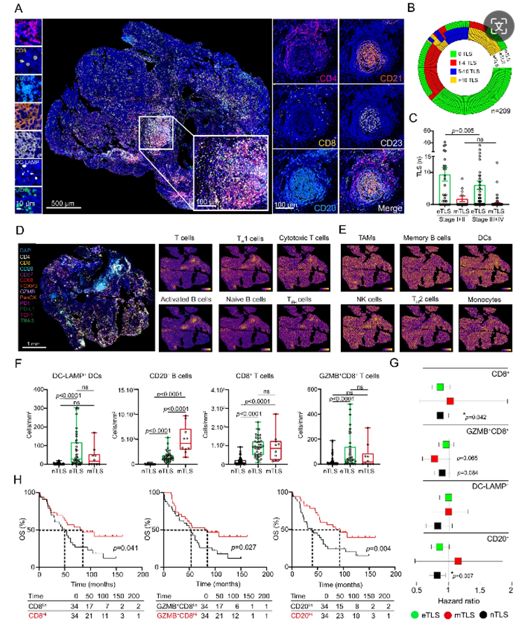 Literature Analysis: Multiplex Fluorescence IHC Empowers Research on Tertiary Lymphoid Structures (TLS) in Tumor Immunity