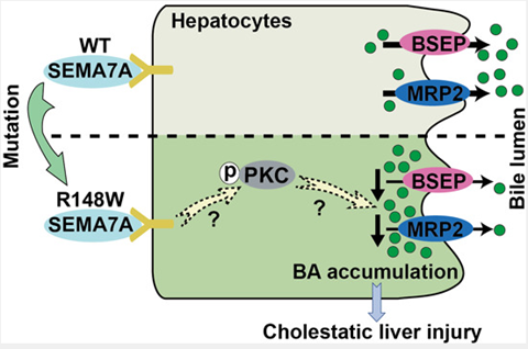 Literature Analysis: SEMA7A Mutation Uncovers a Novel Pathogenic Mechanism of PFIC, Empowered by ANT BIO's Multiplex Fluorescence IHC Kit