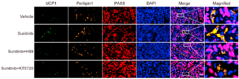 Literature Analysis: Bidirectional Crosstalk Between Clear Cell Renal Cell Carcinoma (ccRCC) and Perirenal Adipose Tissue, Empowered by ANT BIO's Multiplex Fluorescence IHC Solutions