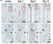 Literature Analysis: Application of Multiplex Fluorescence IHC in Exploring Cell Migration and Differentiation During Orthodontic Tooth Movement