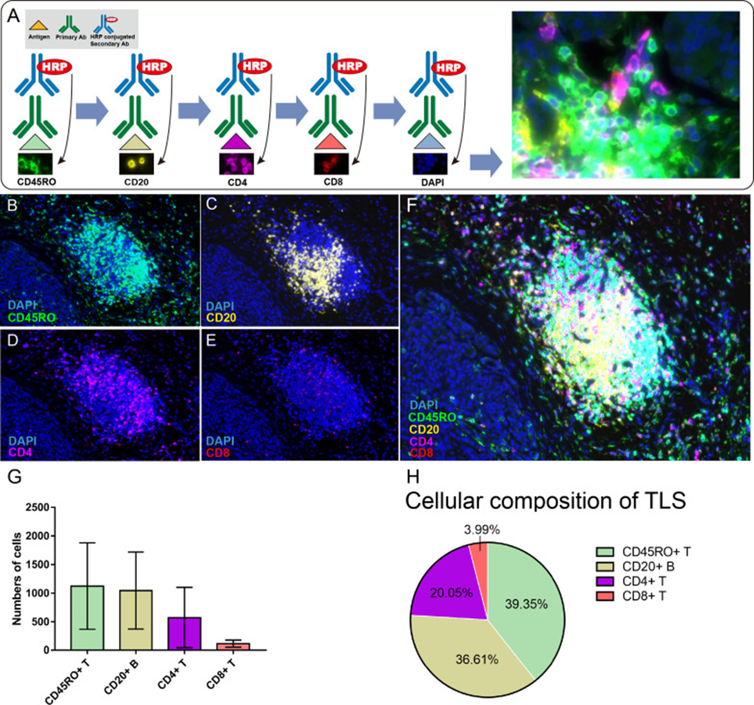 Literature Analysis: Application of Multiplex Fluorescence IHC in Tert ...