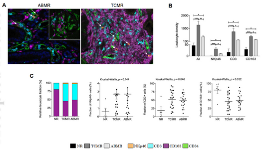 Literature Analysis: Application of Multiplex Fluorescence IHC in the Evaluation of Organ Transplant Rejection