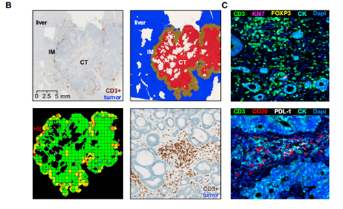 Literature Analysis: Application of Multiplex Fluorescence IHC in Deciphering Metastatic Mechanisms of Colorectal Cancer