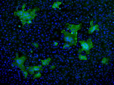 Hot Research Topic: Multiplex Immunohistochemistry (mIHC) vs. Immunofluorescence (IF) – Principles, Differences and Applications