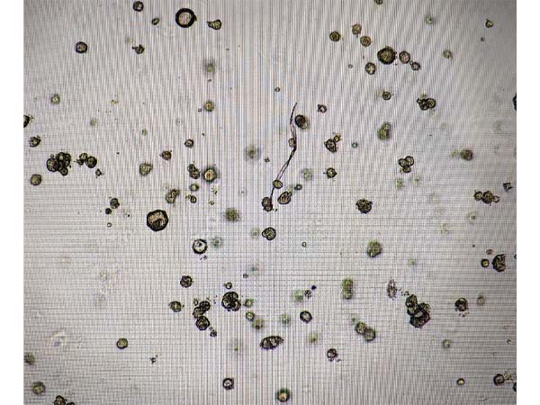 Why are organoids not long after passage?