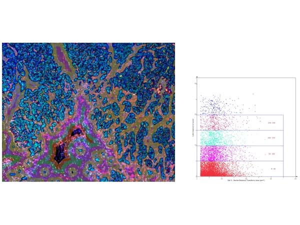 Albison panoramic multi-labeled tissue microenvironment staining analysis