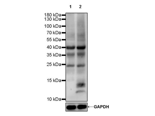 Exploring Acetylation: The "Chemical Code" of Cellular Regulation and Precise Detection